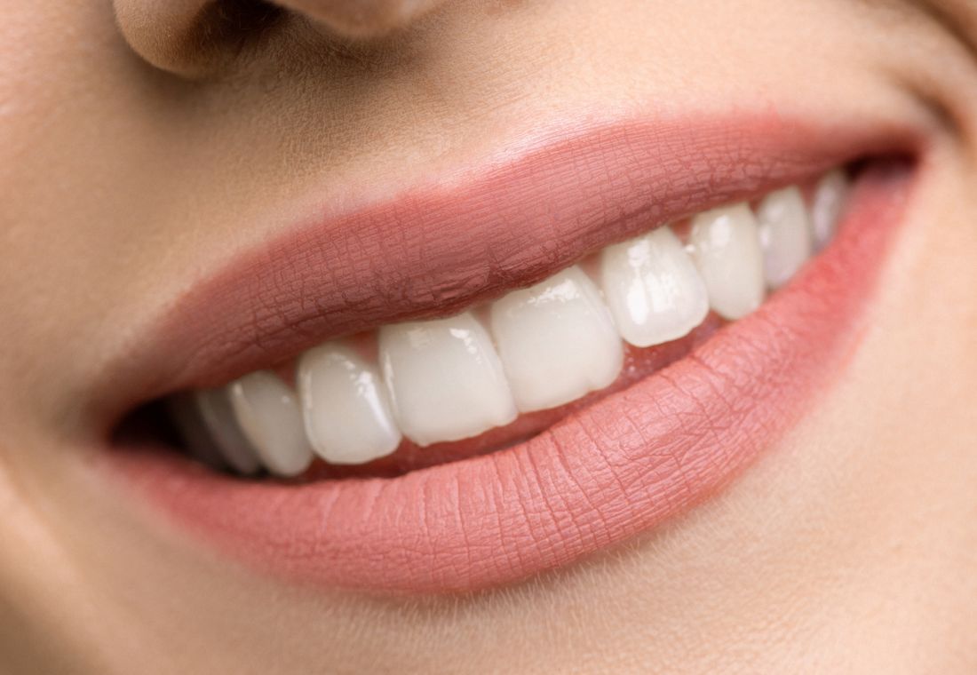 Sonrisa saludable